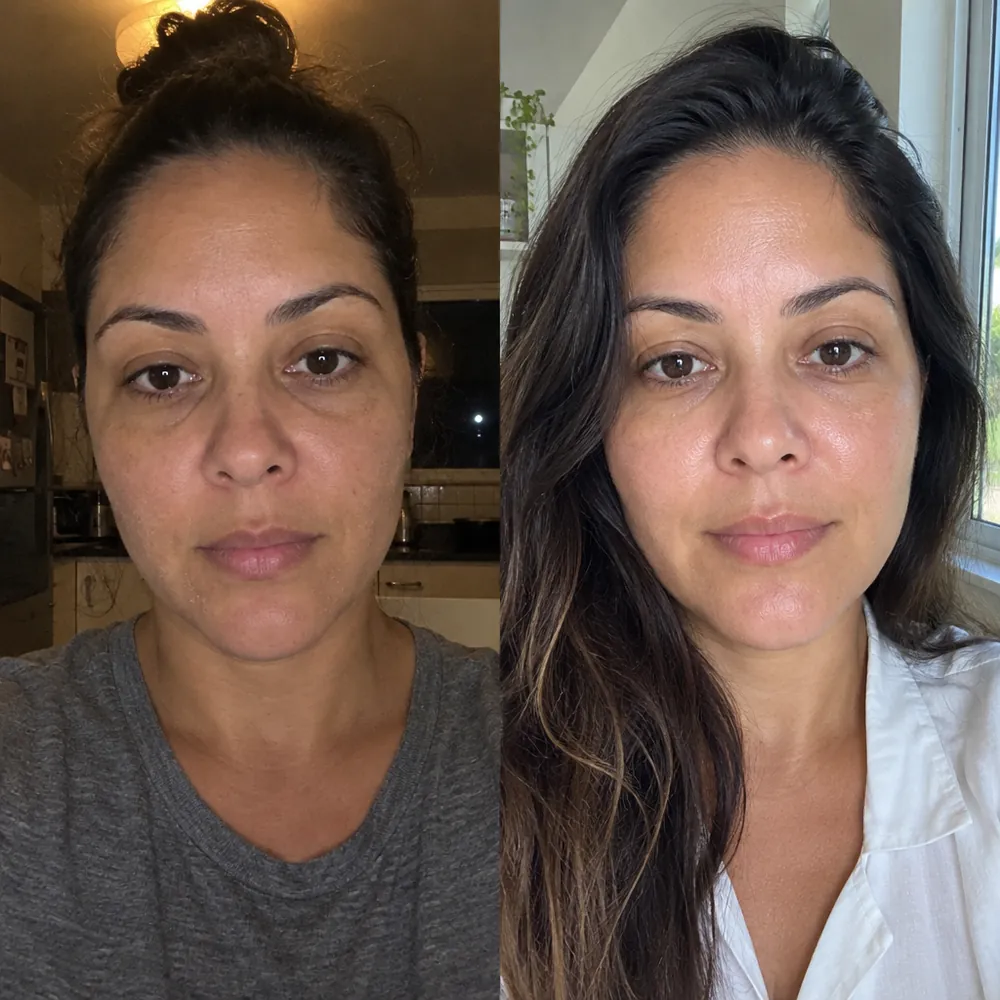 Antes e depois: pele opaca e depois com viço