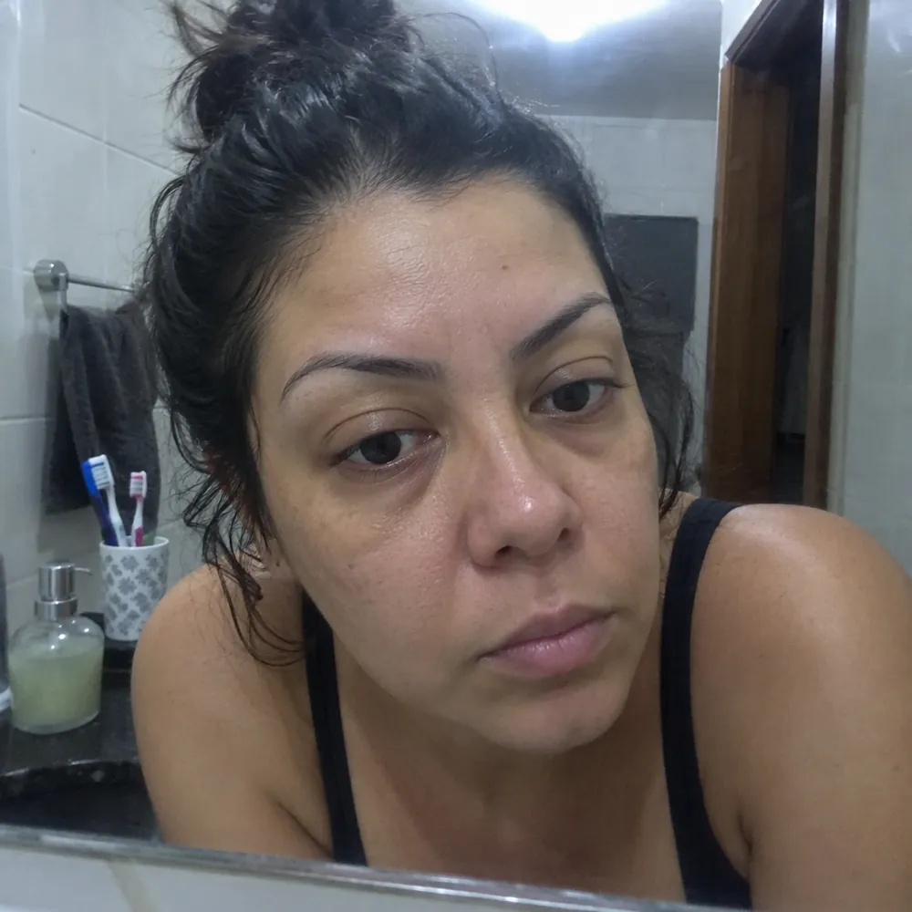 Pele opaca e cansada em close
